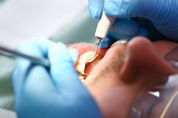Best Walk-In Emergency Dental Services in Ash Flat, AR
