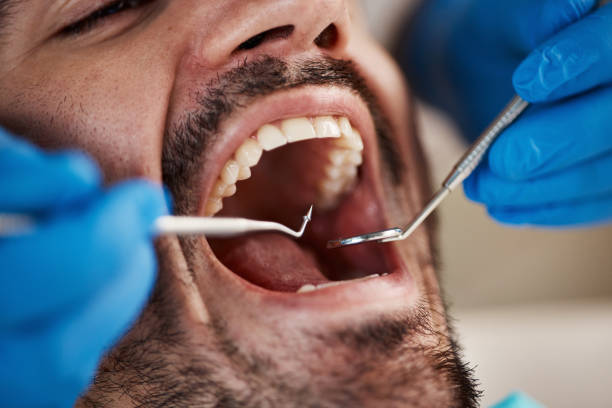 Best Emergency Cosmetic Dentistry (e.g., broken veneers) in Ash Flat, AR